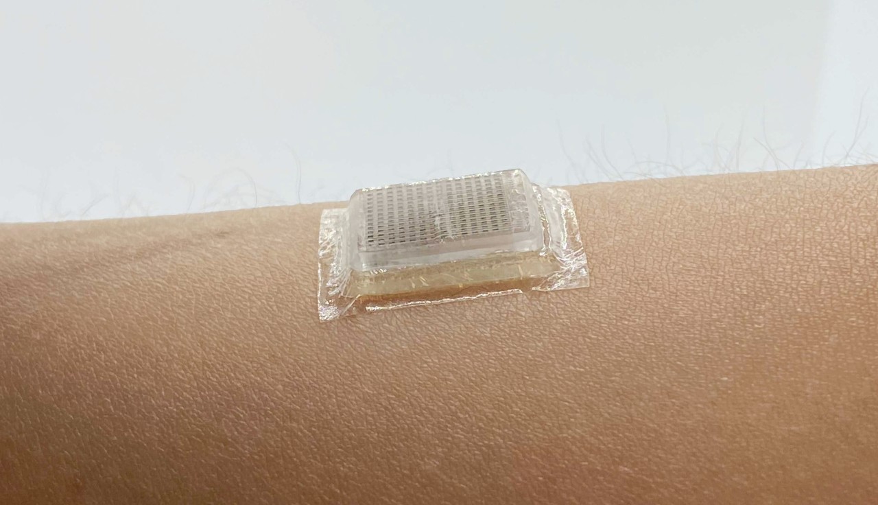 Body stickers that could make ultrasound imaging seamless | Dell France